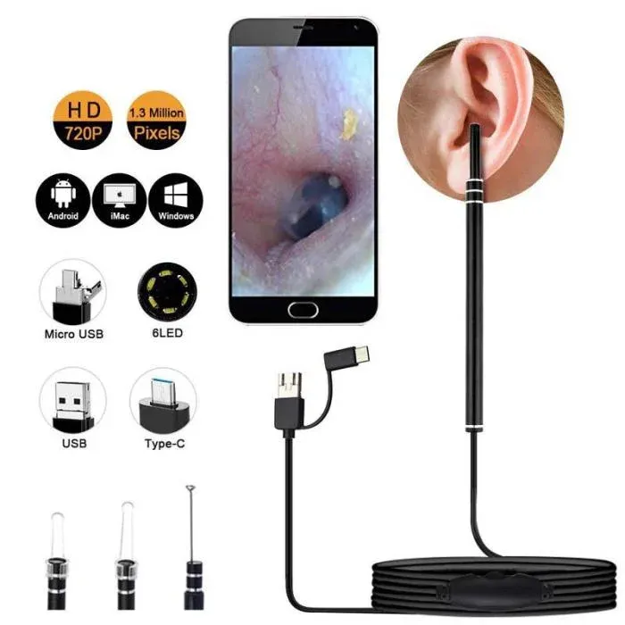 Smart Visual Ear Endoscope Camera