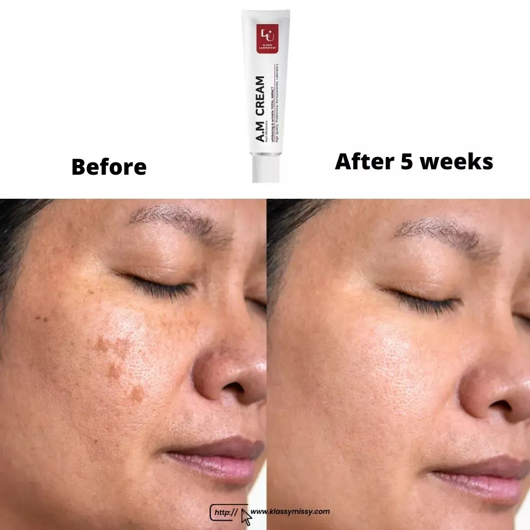 W.Skin Laboratory A.M Cream (Anti-Melasma) 