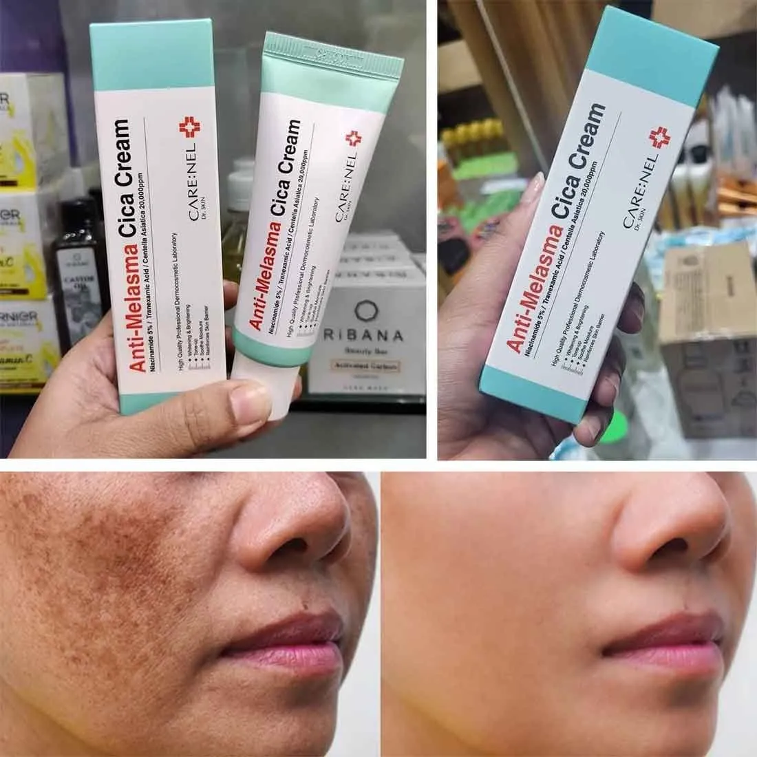 Care:Nel Anti-Melasma Cica Cream ✨