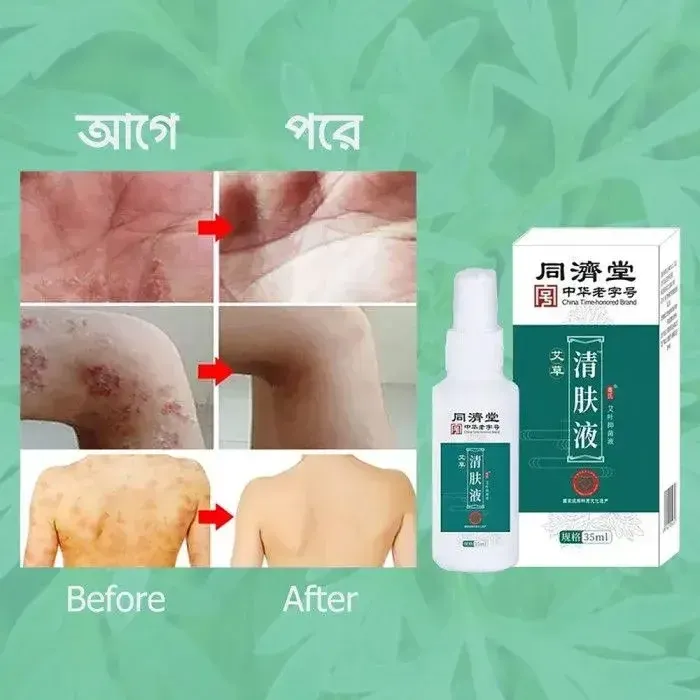 থাম্বনেইল 4