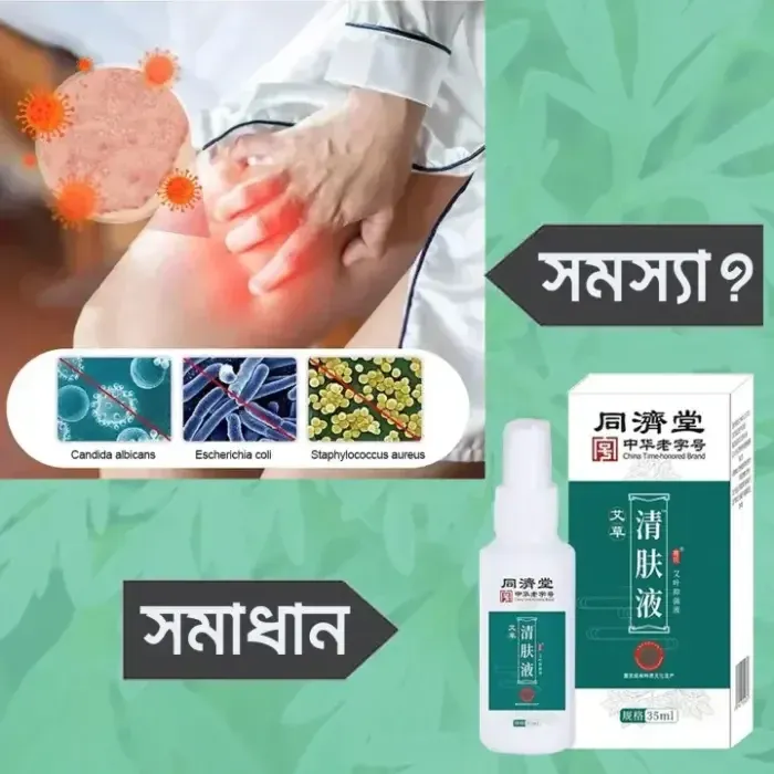 থাম্বনেইল 3