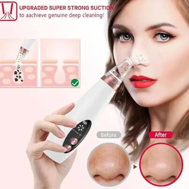 Electric Blackhead Remover Vacuum